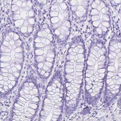 Immunohistochemistry-Paraffin: ERP27 Antibody [NBP1-88393]