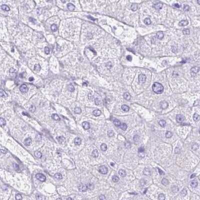Immunohistochemistry-Paraffin: ERP27 Antibody [NBP1-88393]