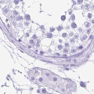 Immunohistochemistry-Paraffin: ERP27 Antibody [NBP1-88393]