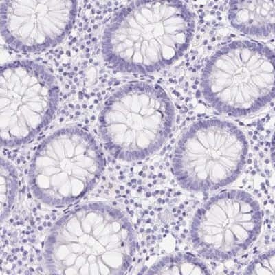 Immunohistochemistry-Paraffin: ERP27 Antibody [NBP2-38679]