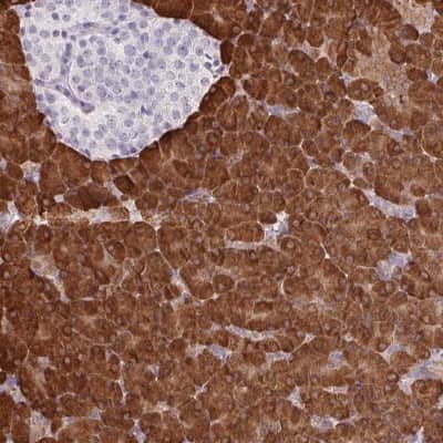 Immunohistochemistry-Paraffin: ERP27 Antibody [NBP2-38679]