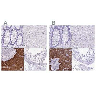 Immunohistochemistry-Paraffin: ERP27 Antibody [NBP2-38679]