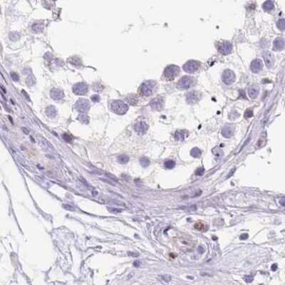 Immunohistochemistry-Paraffin: ERP27 Antibody [NBP2-38679]