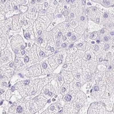 Immunohistochemistry-Paraffin: ERP27 Antibody [NBP2-38679]