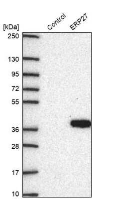 Western Blot: ERP27 Antibody [NBP2-38679]