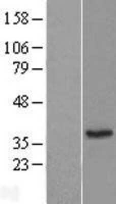 Western Blot: ERP27 Overexpression Lysate [NBL1-10337]
