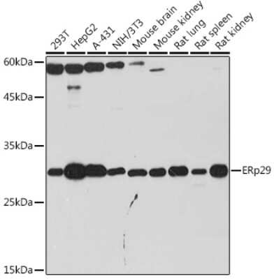 Western Blot: ERP29 Antibody (1J0D3) [NBP3-15906]