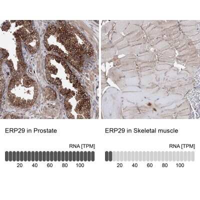 Immunohistochemistry-Paraffin: ERP29 Antibody [NBP1-88395]