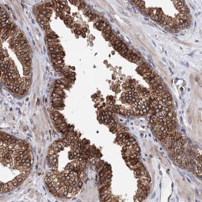 Immunohistochemistry-Paraffin: ERP29 Antibody [NBP1-88396]