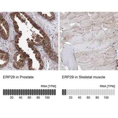Immunohistochemistry-Paraffin: ERP29 Antibody [NBP1-88396]
