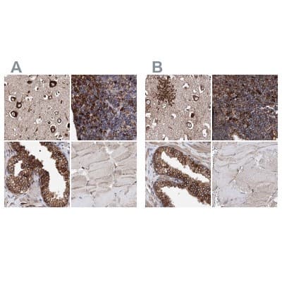 Immunohistochemistry-Paraffin: ERP29 Antibody [NBP1-88396]
