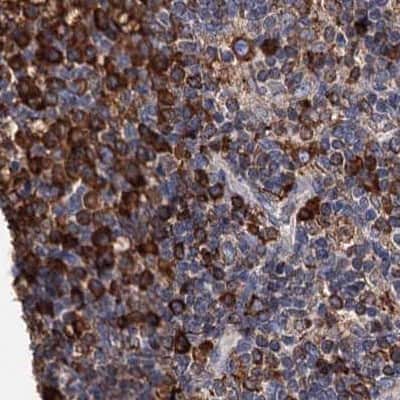 Immunohistochemistry-Paraffin: ERP29 Antibody [NBP1-88396]