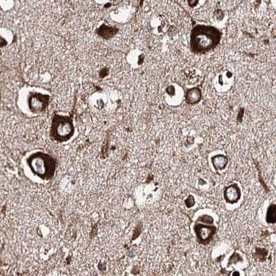 Immunohistochemistry-Paraffin: ERP29 Antibody [NBP1-88396]
