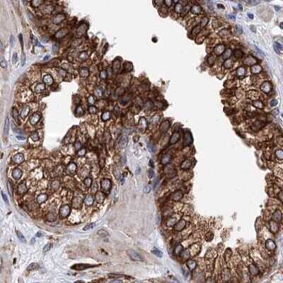 Immunohistochemistry-Paraffin: ERP29 Antibody [NBP1-88396]