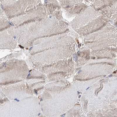 Immunohistochemistry-Paraffin: ERP29 Antibody [NBP1-88396]