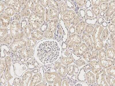 Immunohistochemistry-Paraffin: ERP29 Antibody [NBP2-99200]