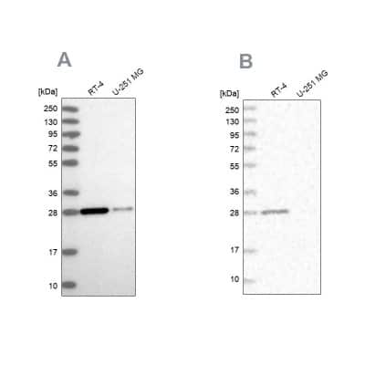 Western Blot: ERP29 Antibody [NBP1-88396]