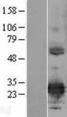 Western Blot: ERP29 Overexpression Lysate [NBL1-10338]