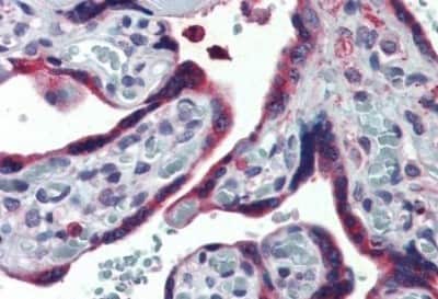 Immunohistochemistry-Paraffin: ERP44 Antibody [NBP3-14317]