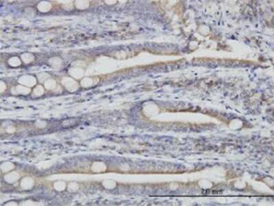Immunohistochemistry-Paraffin: ERP44 Antibody (3C7) [H00023071-M01]