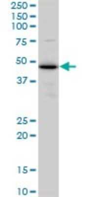 Western Blot: ERP44 Antibody (3C7) [H00023071-M01]