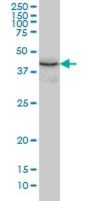 Western Blot: ERP44 Antibody (3C7) [H00023071-M01]