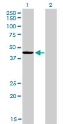 Western Blot: ERP44 Antibody (3C7) [H00023071-M01]