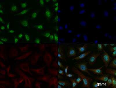 Immunocytochemistry/ Immunofluorescence: ERR alpha/NR3B1 Antibody - BSA Free [NBP1-47254]