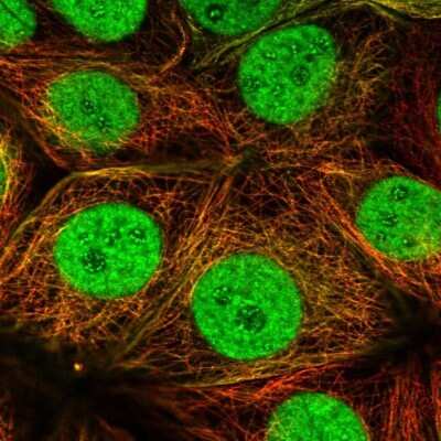 Immunocytochemistry/ Immunofluorescence: ERR alpha/NR3B1 Antibody [NBP2-56812]