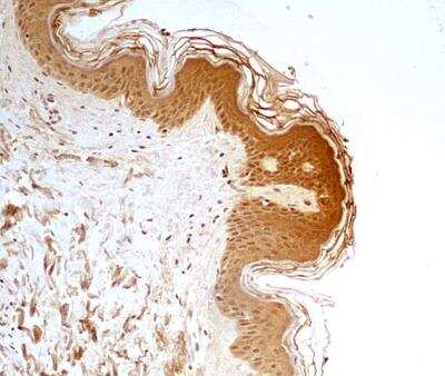 Immunohistochemistry-Paraffin: ERR alpha/NR3B1 Antibody - BSA Free [NBP1-47254]
