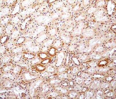 Immunohistochemistry-Paraffin: ERR alpha/NR3B1 Antibody - BSA Free [NBP1-47254]