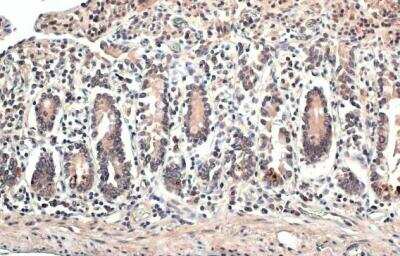 Immunohistochemistry-Paraffin: ERR alpha/NR3B1 Antibody [NBP2-16380]
