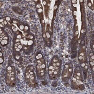 Immunohistochemistry-Paraffin: ERR alpha/NR3B1 Antibody [NBP3-17645]