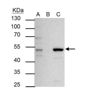 Immunoprecipitation: ERR alpha/NR3B1 Antibody [NBP2-16380]