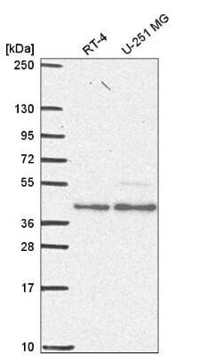 Western Blot: ERR alpha/NR3B1 Antibody [NBP2-56812]