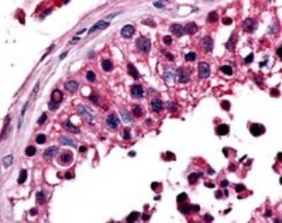 Immunohistochemistry-Paraffin: ERR beta/NR3B2 Antibody - BSA Free [NLS7131]