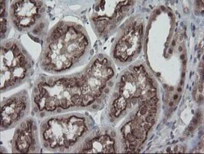 Immunohistochemistry: ERR gamma/NR3B3 Antibody (OTI1E5) [NBP2-45698]