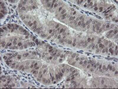 Immunohistochemistry: ERR gamma/NR3B3 Antibody (OTI1E5) [NBP2-45698]
