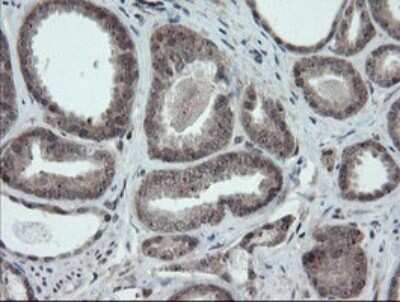 Immunohistochemistry: ERR gamma/NR3B3 Antibody (OTI1E5) [NBP2-45698]