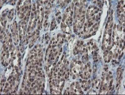 Immunohistochemistry: ERR gamma/NR3B3 Antibody (OTI1E5) [NBP2-45698]