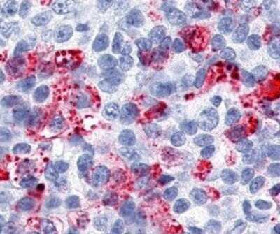 Immunohistochemistry-Paraffin: ERR gamma/NR3B3 Antibody - BSA Free [NLS5960]