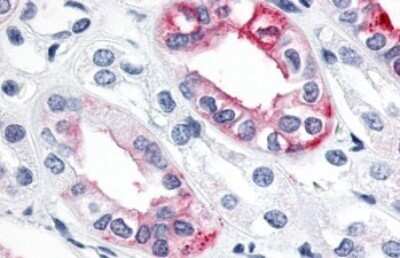 Immunohistochemistry-Paraffin: ERR gamma/NR3B3 Antibody - BSA Free [NLS5960]
