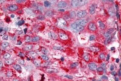 Immunohistochemistry-Paraffin: ERR gamma/NR3B3 Antibody - BSA Free [NLS5960]