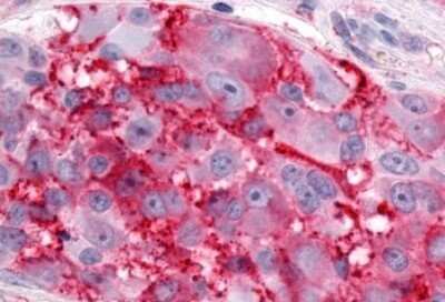 Immunohistochemistry-Paraffin: ERR gamma/NR3B3 Antibody - BSA Free [NLS5960]