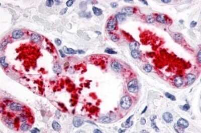 Immunohistochemistry-Paraffin: ERR gamma/NR3B3 Antibody - BSA Free [NLS5960]