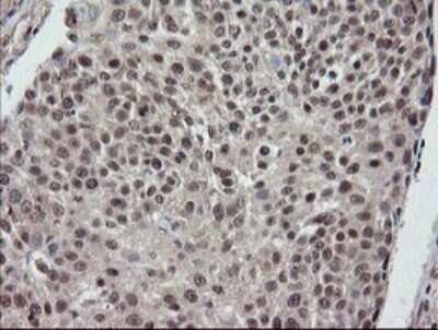 Immunohistochemistry: ERR gamma/NR3B3 Antibody (OTI1E5) - Azide and BSA Free [NBP2-70691]
