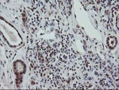 Immunohistochemistry: ERR gamma/NR3B3 Antibody (OTI1E5) - Azide and BSA Free [NBP2-70691]