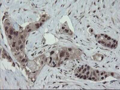 Immunohistochemistry: ERR gamma/NR3B3 Antibody (OTI1E5) - Azide and BSA Free [NBP2-70691]