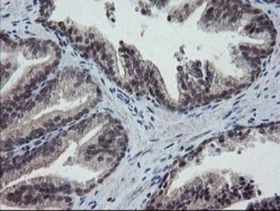Immunohistochemistry: ERR gamma/NR3B3 Antibody (OTI1E5) - Azide and BSA Free [NBP2-70691]