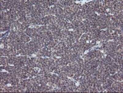 Immunohistochemistry: ERR gamma/NR3B3 Antibody (OTI1E5) - Azide and BSA Free [NBP2-70691]